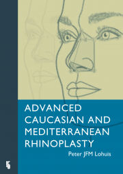 cover_advanced_caucasian_and_mediterraniean_rhinoplasty